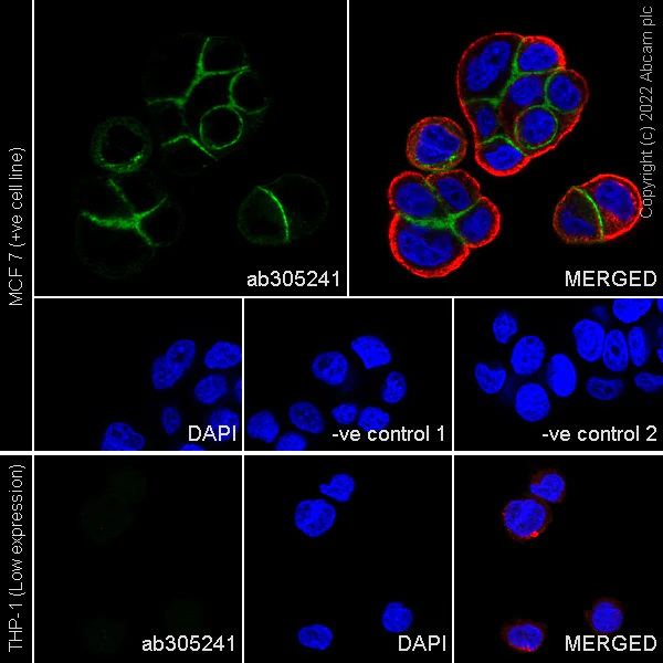 Immunocytochemistry/ Immunofluorescence - Anti-gamma Catenin antibody [15/γ-Catenin] - BSA and Azide Free (AB305242)