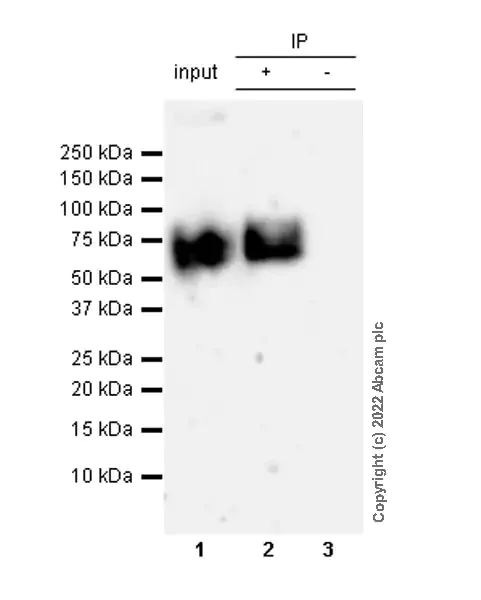 Immunoprecipitation - Anti-gamma Catenin antibody [15/γ-Catenin] - BSA and Azide Free (AB305242)