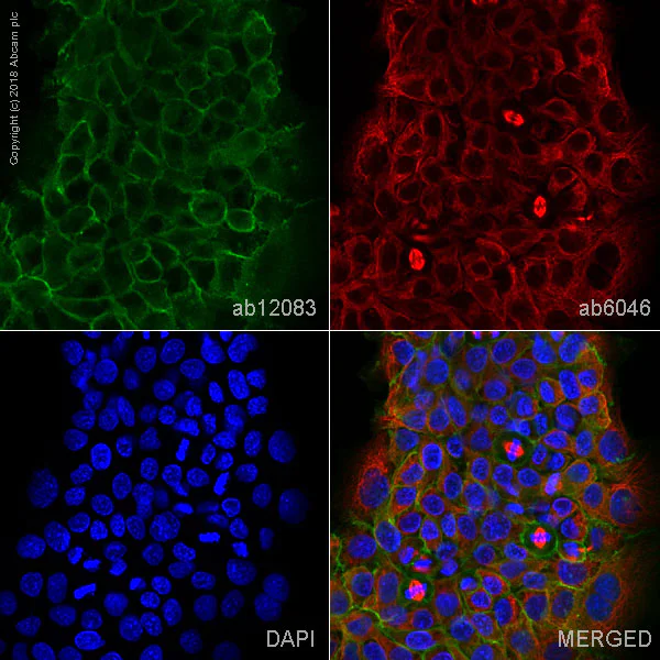 Immunocytochemistry/ Immunofluorescence - Anti-gamma Catenin antibody [15F11] (AB12083)