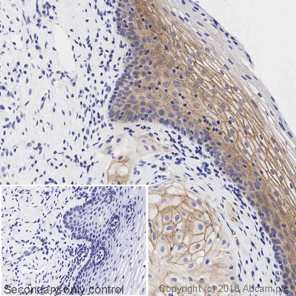 Immunohistochemistry (Formalin/PFA-fixed paraffin-embedded sections) - Anti-gamma Catenin antibody [15F11] (AB12083)