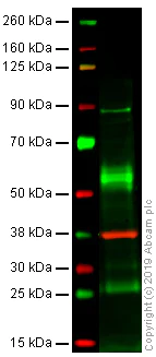 Western blot - Anti-gamma Catenin antibody [15F11] (AB12083)