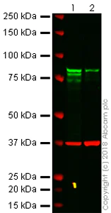 Western blot - Anti-gamma Catenin antibody [15F11] (AB12083)