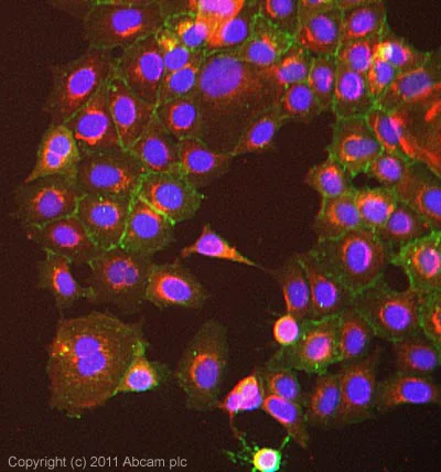 Immunocytochemistry/ Immunofluorescence - Anti-gamma Catenin antibody (AB15153)