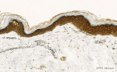 Immunohistochemistry (Formalin/PFA-fixed paraffin-embedded sections) - Anti-gamma Catenin antibody (AB15153), expandable thumbnail