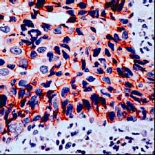 Immunohistochemistry (Formalin/PFA-fixed paraffin-embedded sections) - Anti-gamma Catenin antibody (AB15153), expandable thumbnail