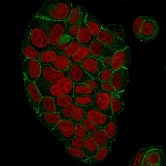 Immunocytochemistry - Anti-gamma Catenin antibody [CTNG/1664] (AB218437), expandable thumbnail