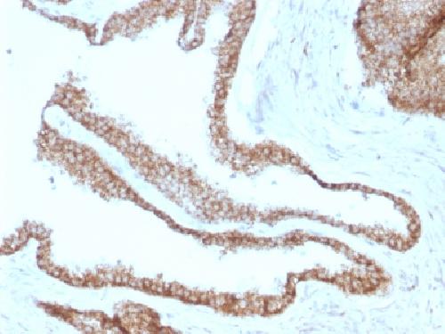 Immunohistochemistry (Formalin/PFA-fixed paraffin-embedded sections) - Anti-gamma Catenin antibody [CTNG/1664] (AB218437), expandable thumbnail