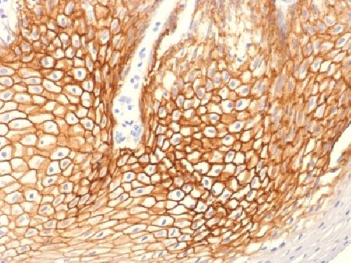 Immunohistochemistry (Formalin/PFA-fixed paraffin-embedded sections) - Anti-gamma Catenin antibody [CTNG/1664] (AB218437), expandable thumbnail