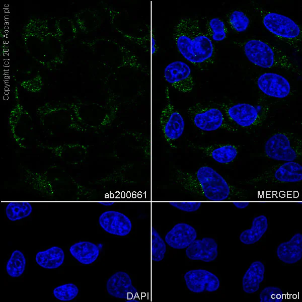 Immunocytochemistry/ Immunofluorescence - Anti-gamma Catenin antibody [EPR17310-48] (AB200661)