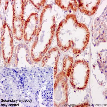 Immunohistochemistry (Formalin/PFA-fixed paraffin-embedded sections) - Anti-gamma Catenin antibody [EPR17310-48] (AB200661), expandable thumbnail