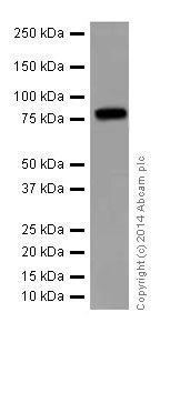 Western blot - Anti-gamma Catenin antibody [EPR17310-48] (AB200661), expandable thumbnail