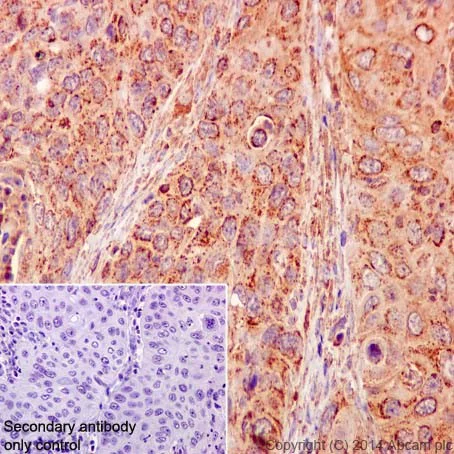 Immunohistochemistry (Formalin/PFA-fixed paraffin-embedded sections) - Anti-gamma Catenin antibody [EPR17310-48] - BSA and Azide free (AB251317)