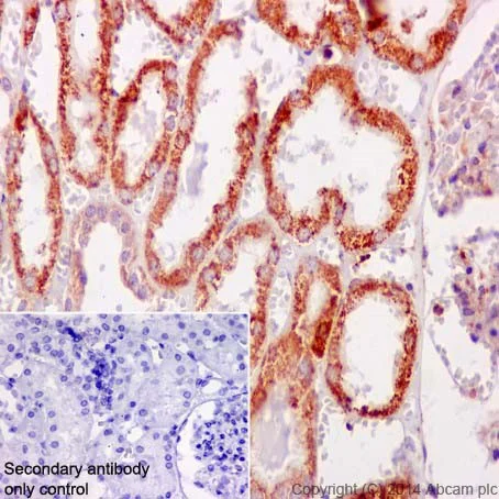 Immunohistochemistry (Formalin/PFA-fixed paraffin-embedded sections) - Anti-gamma Catenin antibody [EPR17310-48] - BSA and Azide free (AB251317)