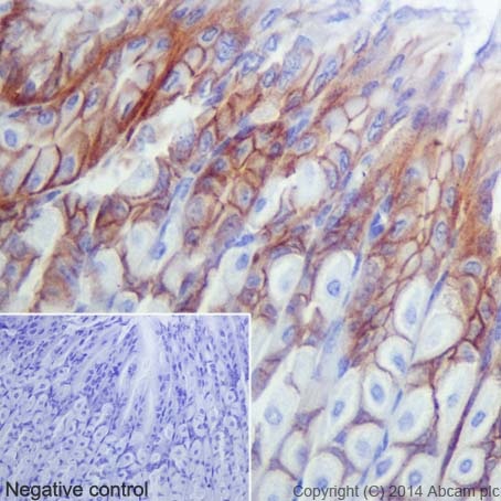 Anti-gamma Catenin antibody [EPR17310] KO tested (ab184919) | Abcam