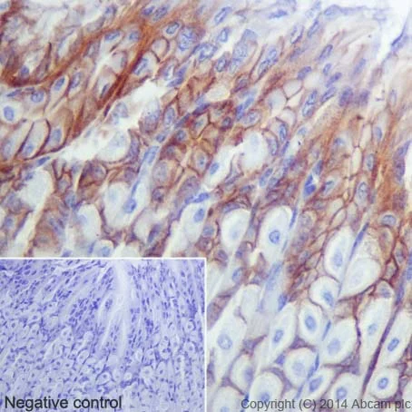 Immunohistochemistry (Formalin/PFA-fixed paraffin-embedded sections) - Anti-gamma Catenin antibody [EPR17310] (AB184919)