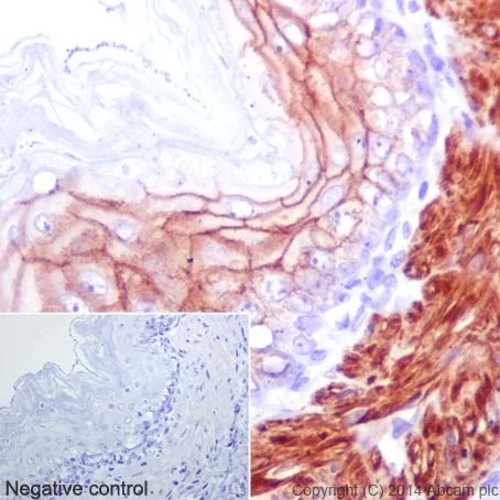 Immunohistochemistry (Formalin/PFA-fixed paraffin-embedded sections) - Anti-gamma Catenin antibody [EPR17310] (AB184919)