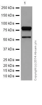Western blot - Anti-gamma Catenin antibody [EPR17310] (AB184919)