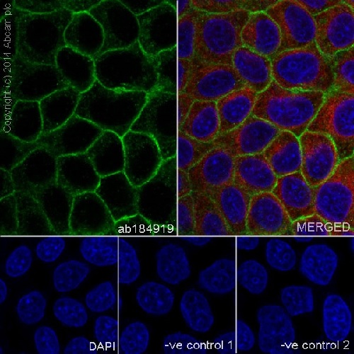 Immunocytochemistry/ Immunofluorescence - Anti-gamma Catenin antibody [EPR17310] - BSA and Azide free (ab238447), expandable thumbnail