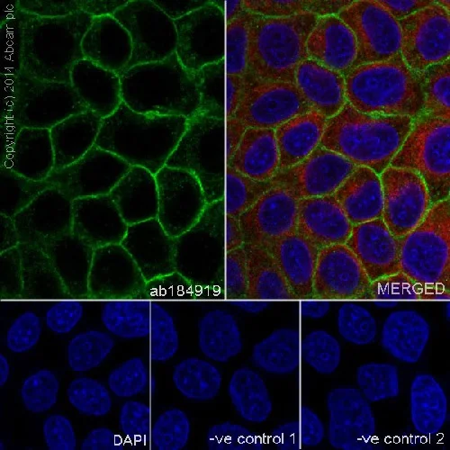 Immunocytochemistry/ Immunofluorescence - Anti-gamma Catenin antibody [EPR17310] - BSA and Azide free (AB238447)