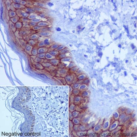 Immunohistochemistry (Formalin/PFA-fixed paraffin-embedded sections) - Anti-gamma Catenin antibody [EPR17310] - BSA and Azide free (AB238447), expandable thumbnail