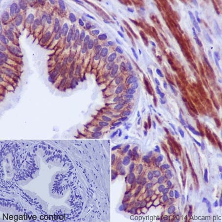 Immunohistochemistry (Formalin/PFA-fixed paraffin-embedded sections) - Anti-gamma Catenin antibody [EPR17310] - BSA and Azide free (AB238447), expandable thumbnail