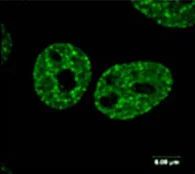 Immunocytochemistry/ Immunofluorescence - Anti-gamma H2A.X (phospho S139) antibody [3F2] (AB22551)
