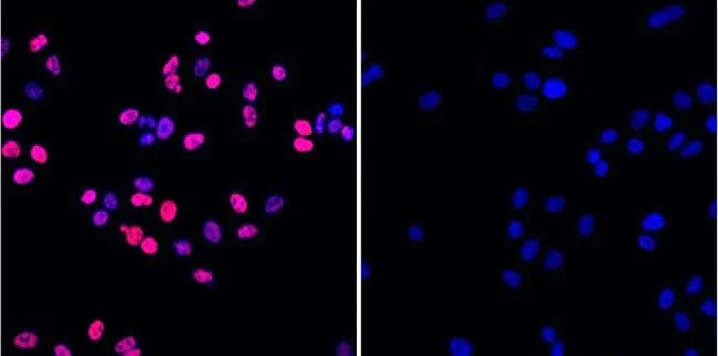 Immunocytochemistry/ Immunofluorescence - Anti-gamma H2A.X (phospho S139) antibody [3F2] (AB22551)