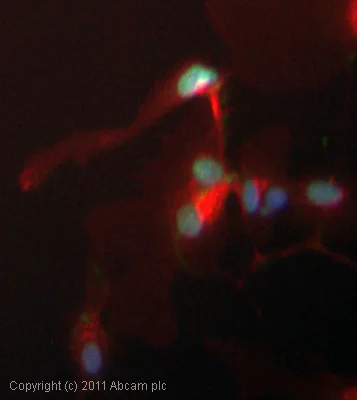 Immunocytochemistry/ Immunofluorescence - Anti-gamma H2A.X (phospho S139) antibody [3F2] (AB22551)