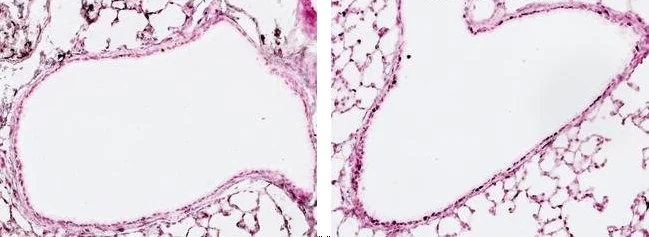 Immunohistochemistry (Formalin/PFA-fixed paraffin-embedded sections) - Anti-gamma H2A.X (phospho S139) antibody [3F2] (AB22551)