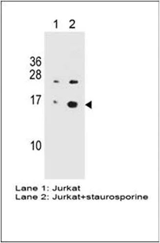Anti-GH2AX (phospho S139) antibody [3F2] (ab22551) | Abcam