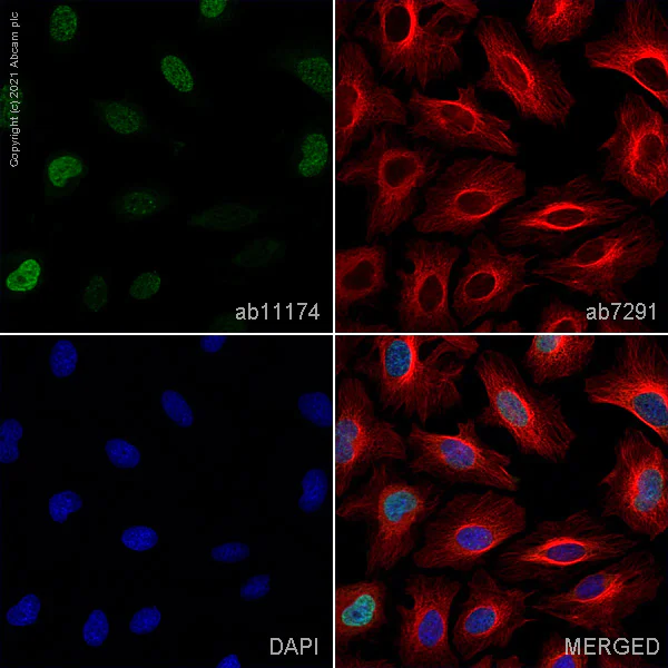 Anti-gamma H2A.X (phospho S139) antibody (ab11174) | Abcam