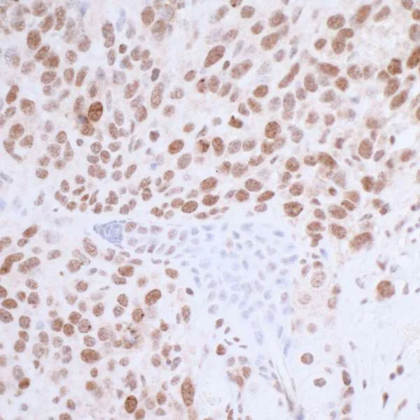 Immunohistochemistry (Formalin/PFA-fixed paraffin-embedded sections) - Anti-gamma H2A.X (phospho S139) antibody (AB11174)