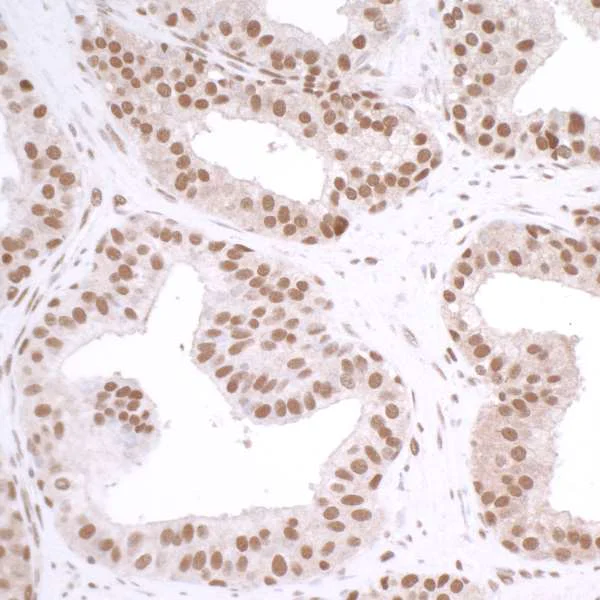 Immunohistochemistry (Formalin/PFA-fixed paraffin-embedded sections) - Anti-gamma H2A.X (phospho S139) antibody (AB11174)