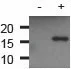 Western blot - Anti-gamma H2A.X (phospho S139) antibody (AB11174)