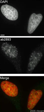 Immunocytochemistry/ Immunofluorescence - Anti-gamma H2A.X (phospho S139) antibody (AB2893)