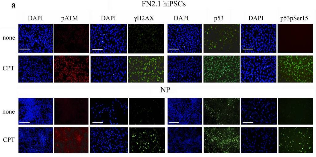 Immunocytochemistry/ Immunofluorescence - Anti-gamma H2A.X (phospho S139) antibody (AB2893), expandable thumbnail