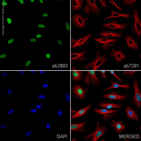 Immunocytochemistry/ Immunofluorescence - Anti-gamma H2A.X (phospho S139) antibody (AB2893)