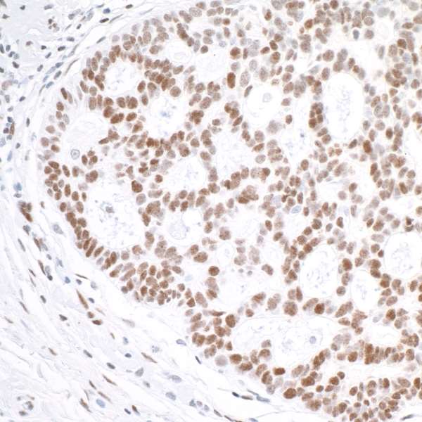 Immunohistochemistry (Formalin/PFA-fixed paraffin-embedded sections) - Anti-gamma H2A.X (phospho S139) antibody [BLR053F] (AB243906)