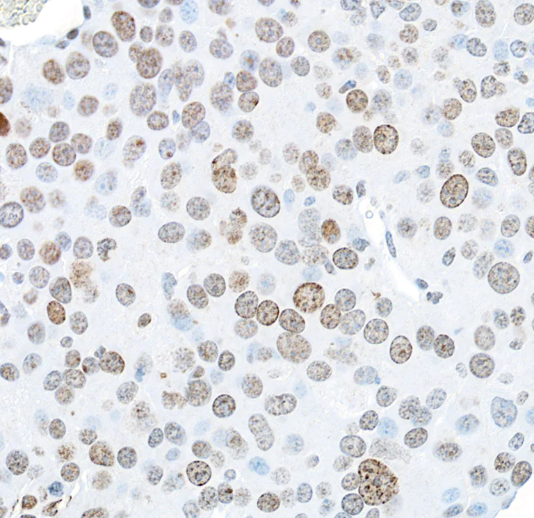 Immunohistochemistry (Formalin/PFA-fixed paraffin-embedded sections) - Anti-gamma H2A.X (phospho S139) antibody [BLR053F] (AB243906)