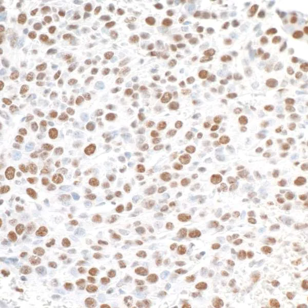 Immunohistochemistry (Formalin/PFA-fixed paraffin-embedded sections) - Anti-gamma H2A.X (phospho S139) antibody [BLR053F] (AB243906)