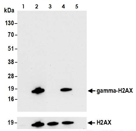 Anti-gamma H2A.X (phospho S139) antibody [BLR053F] (ab243906) | Abcam