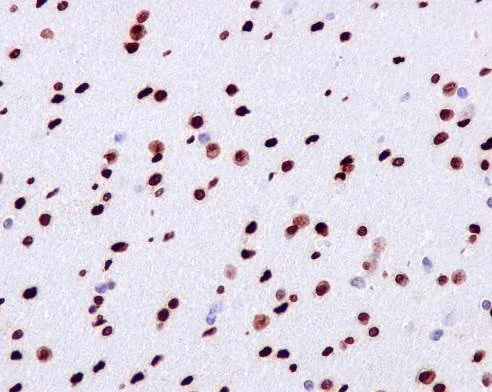 Immunohistochemistry (Formalin/PFA-fixed paraffin-embedded sections) - Anti-gamma H2A.X (phospho S139) antibody [EP854(2)Y] (AB81299)