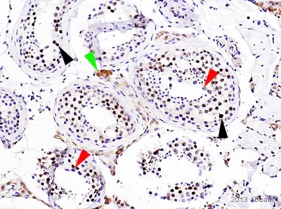 Immunohistochemistry (Formalin/PFA-fixed paraffin-embedded sections) - Anti-gamma H2A.X (phospho S139) antibody [EP854(2)Y] (AB81299)