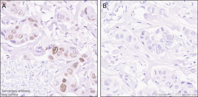 Immunohistochemistry (Formalin/PFA-fixed paraffin-embedded sections) - Anti-gamma H2A.X (phospho S139) antibody [EP854(2)Y] (AB81299)