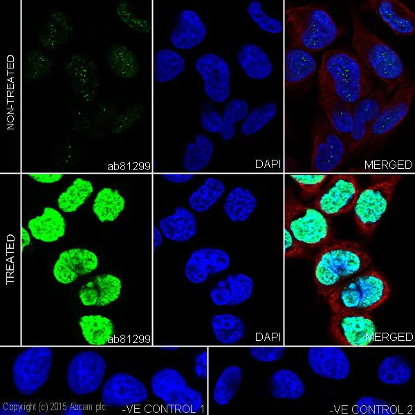 Immunocytochemistry/ Immunofluorescence - Anti-gamma H2A.X (phospho S139) antibody [EP854(2)Y] - BSA and Azide free (AB215967)