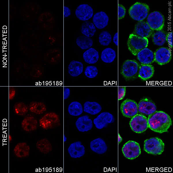 Immunocytochemistry/ Immunofluorescence - Anti-gamma H2A.X (phospho S139) antibody [EP854(2)Y] - BSA and Azide free (AB215967)