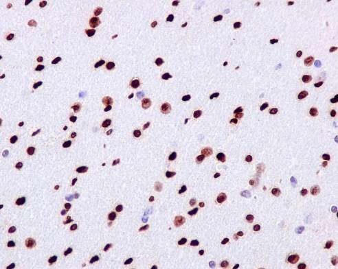 Immunohistochemistry (Formalin/PFA-fixed paraffin-embedded sections) - Anti-gamma H2A.X (phospho S139) antibody [EP854(2)Y] - BSA and Azide free (ab215967), expandable thumbnail