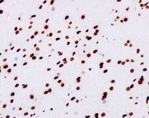 Immunohistochemistry (Formalin/PFA-fixed paraffin-embedded sections) - Anti-gamma H2A.X (phospho S139) antibody [EP854(2)Y] - BSA and Azide free (ab215967), expandable thumbnail
