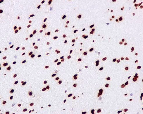 Immunohistochemistry (Formalin/PFA-fixed paraffin-embedded sections) - Anti-gamma H2A.X (phospho S139) antibody [EP854(2)Y] - BSA and Azide free (AB215967)