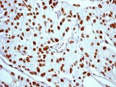 Immunohistochemistry (Formalin/PFA-fixed paraffin-embedded sections) - Anti-gamma H2A.X (phospho S139) antibody [EP854(2)Y] - BSA and Azide free (ab215967), expandable thumbnail